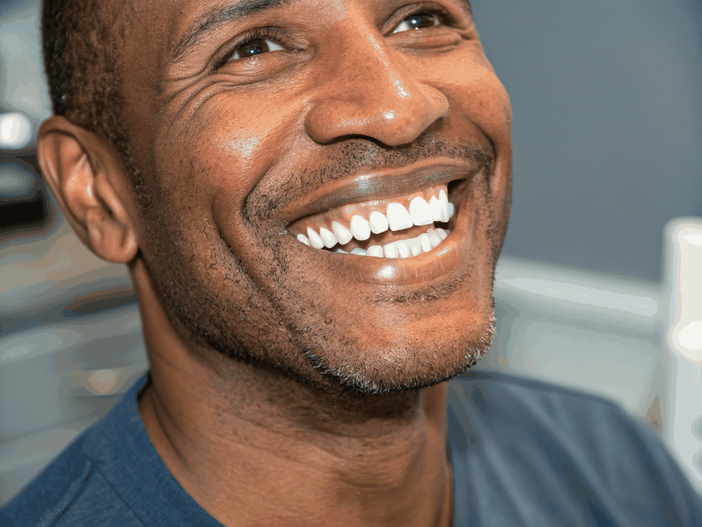 Diastema Closure & Enamel Reshaping after treatment